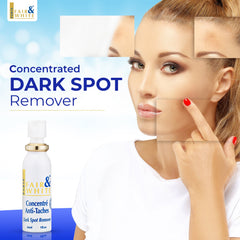 Fair & White Original Dark Spot Remover Soft Radiant Skin