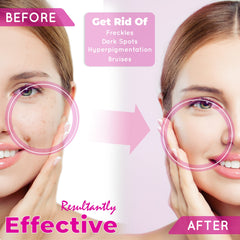 Fair & White So White Skin Perfector Gel - Dark Spot Remover