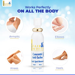 Fair & White Original Dark Spot Remover Soft Radiant Skin