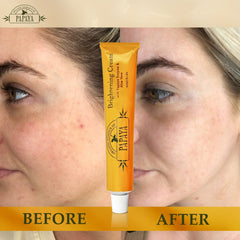 Organic Extract of Papaya Normal-Dry Skin Combo